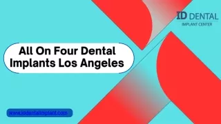 All On Four Dental Implants Los Angeles
