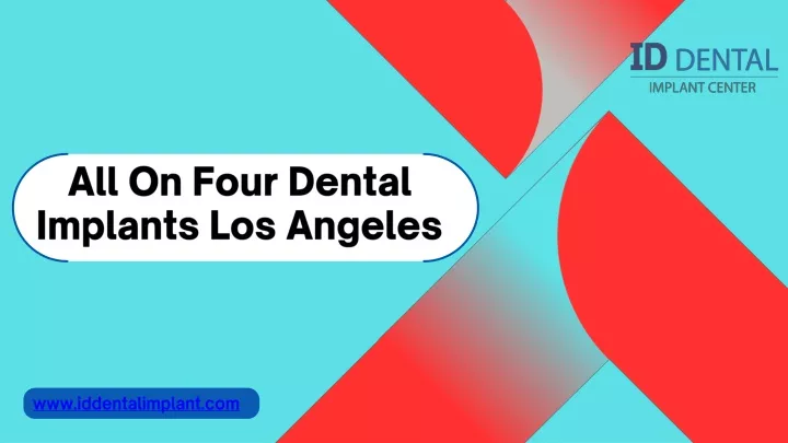 all on four dental implants los angeles