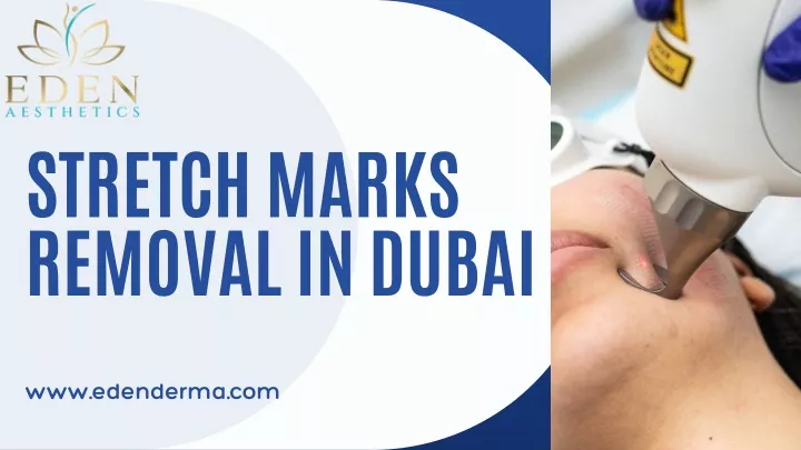 stretch marks removal in dubai