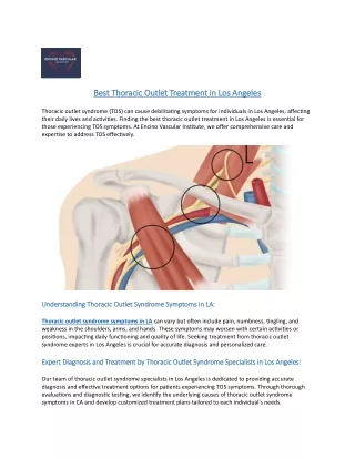 Best Thoracic Outlet Treatment in Los Angeles