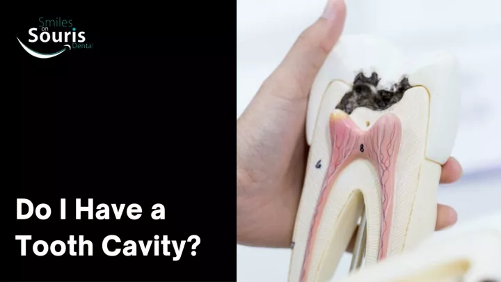 do i have a tooth cavity