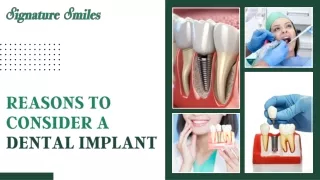 Exploring the Compelling Reasons for Dental Implants
