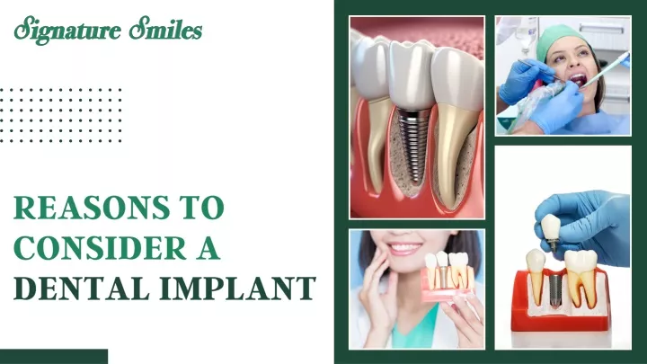 reasons to consider a dental implant