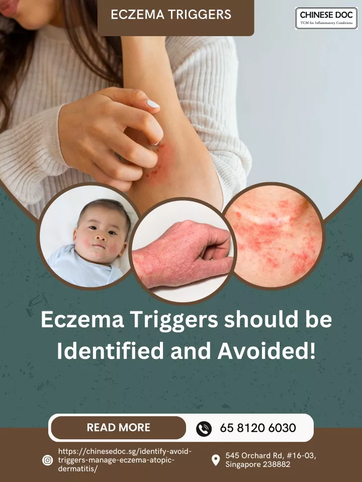 eczema triggers