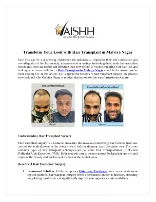 Transform Your Look with Hair Transplant in Malviya Nagar