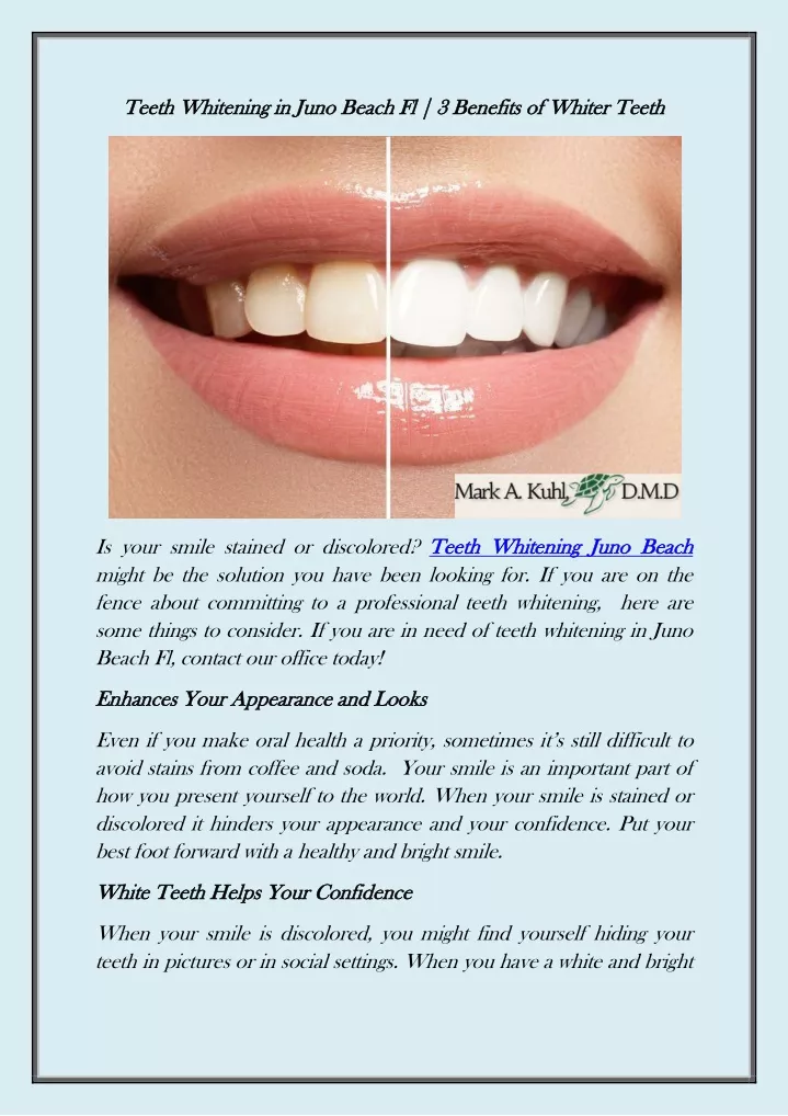 teeth whitening in juno beach fl 3 benefits
