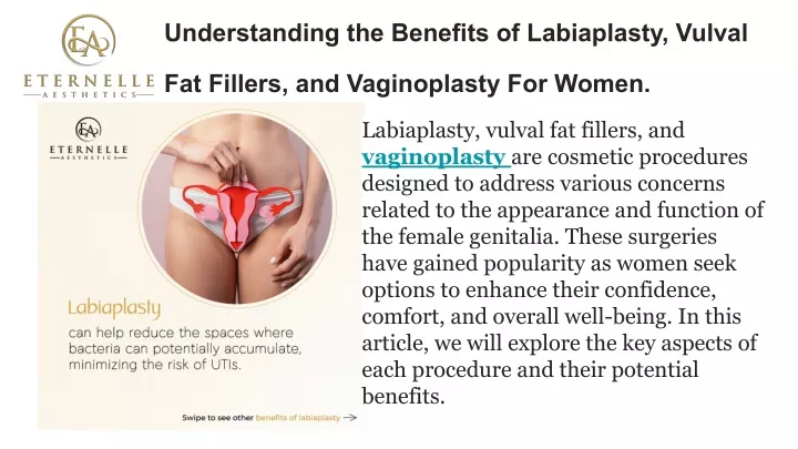 understanding the benefits of labiaplasty vulval