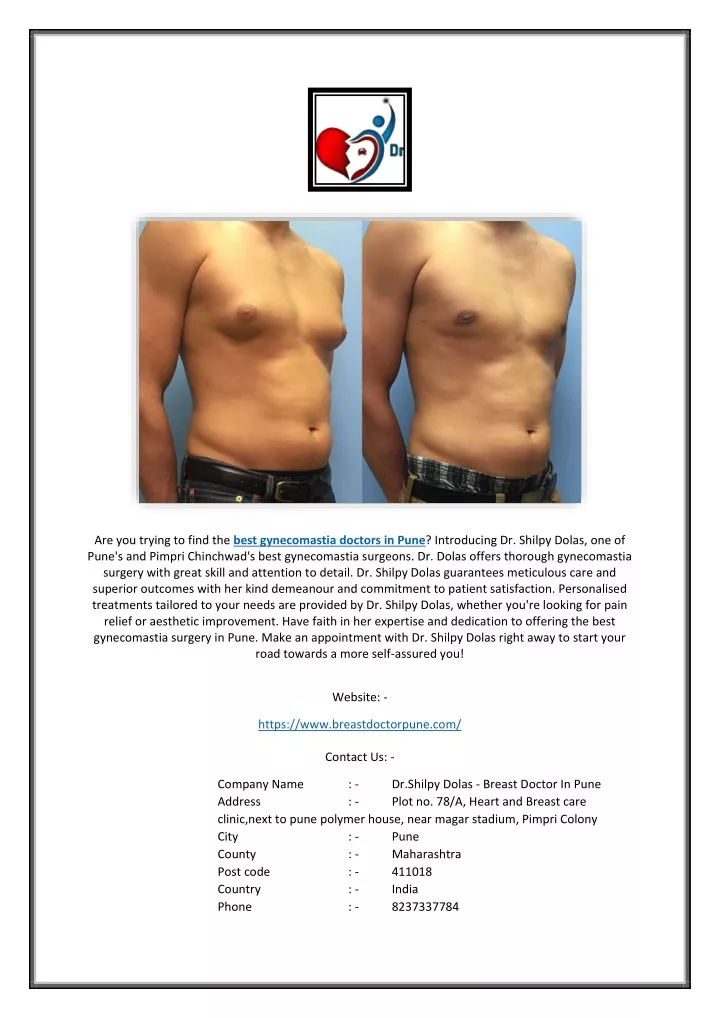 are you trying to find the best gynecomastia