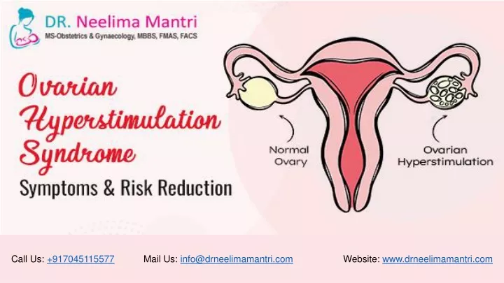 Ppt Ovarian Hyperstimulation Syndrome Symptoms And Risk Reduction Dr Neelima Mantr 