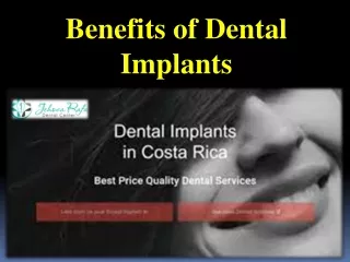 Benefits of Dental Implants