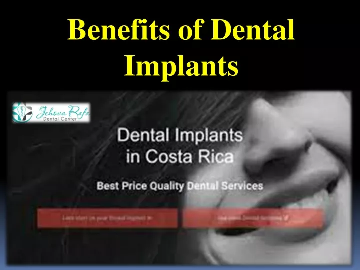 benefits of dental implants