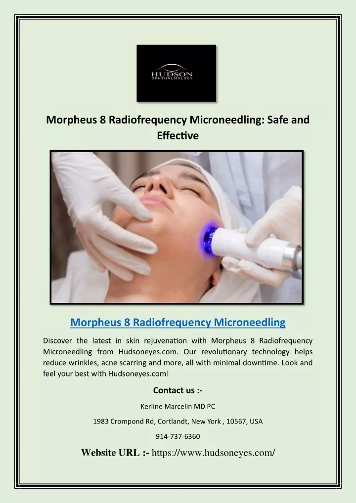 morpheus 8 radiofrequency microneedling safe