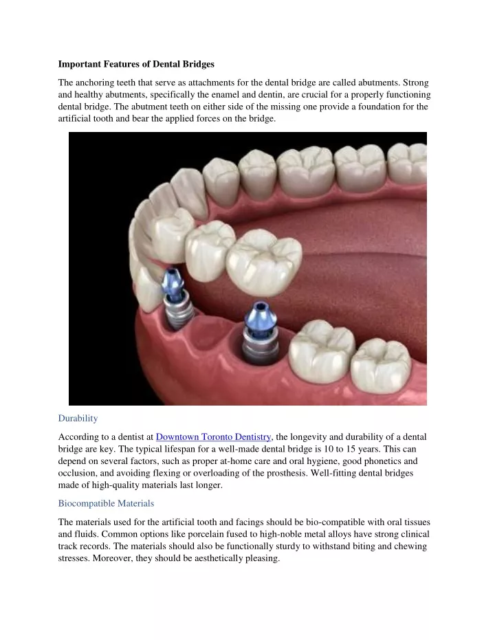 important features of dental bridges