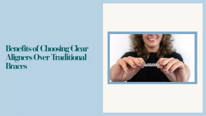 benefits of choosing clear aligners over