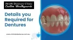 Details you required for dentures PPT - slide 1