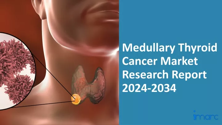 medullary thyroid cancer market research report 2024 2034
