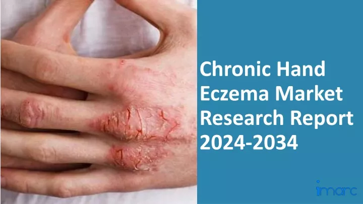 chronic hand eczema market research report 2024 2034