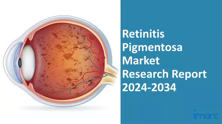 retinitis pigmentosa market research report 2024 2034