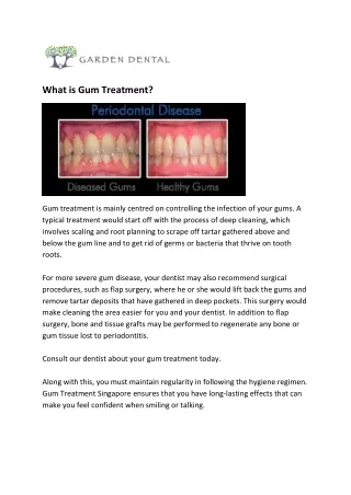 What is Gum Treatment? Gum Treatment in Singpore.