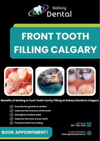 Front Tooth Cavity Filling | Dental Filling in Calgary, AB | Galaxy Dental