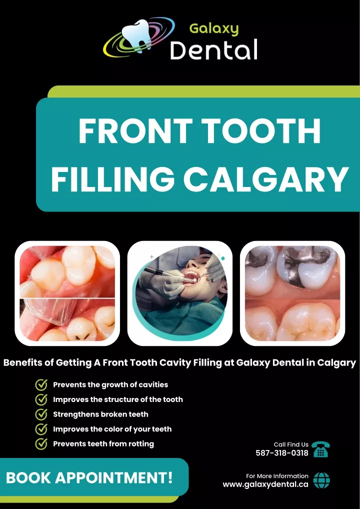 front tooth filling calgary