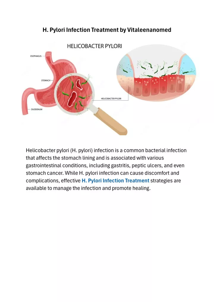 h pylori infection treatment by vitaleenanomed