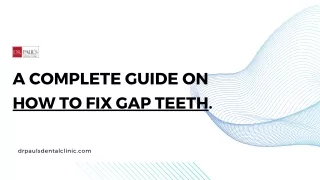 A COMPLETE GUIDE ON HOW TO FIX GAP TEETH.
