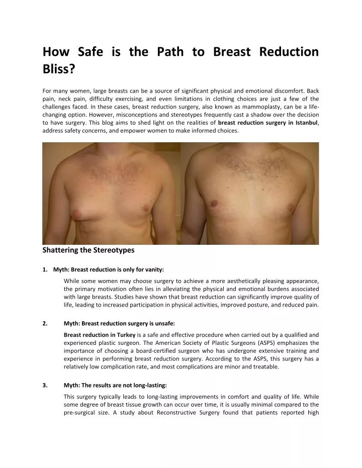 how safe is the path to breast reduction bliss