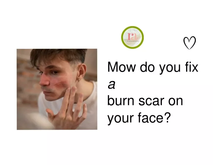 mow do you fix a burn scar on your face