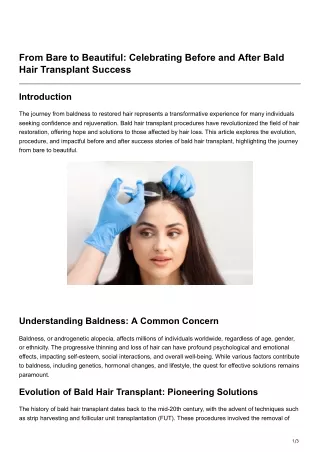 From Bare to Beautiful Celebrating Before and After Bald Hair Transplant Success