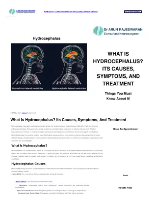 Expert Guidance Hydrocephalus Care by Dr. Arun Rajeswaran
