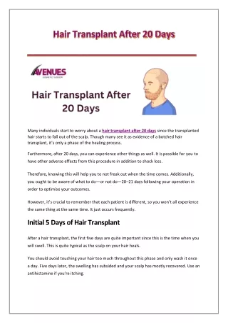 Hair Transplant After 20 Days
