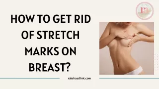 how to get rid of stretch marks on breast