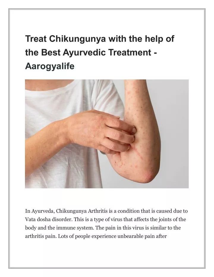 treat chikungunya with the help of the best