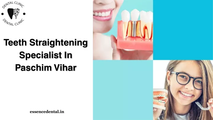 teeth straightening specialist in paschim vihar