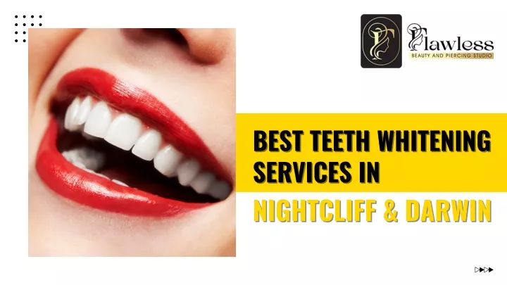 best teeth whitening services in nightcliff darwin