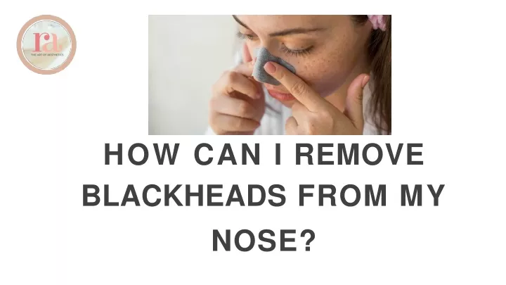 how can i remove blackheads from my nose