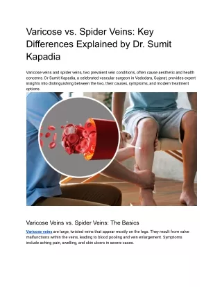 Varicose vs. Spider Veins_ Key Differences Explained by Dr. Sumit Kapadia
