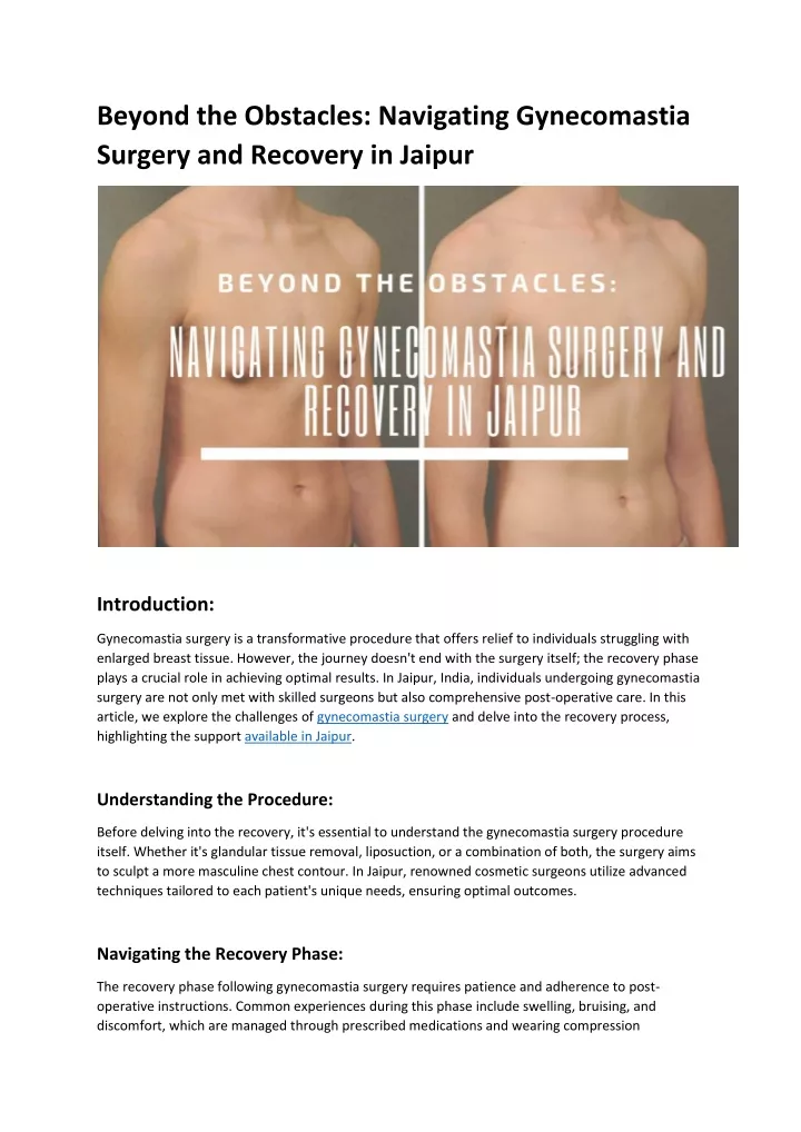 beyond the obstacles navigating gynecomastia