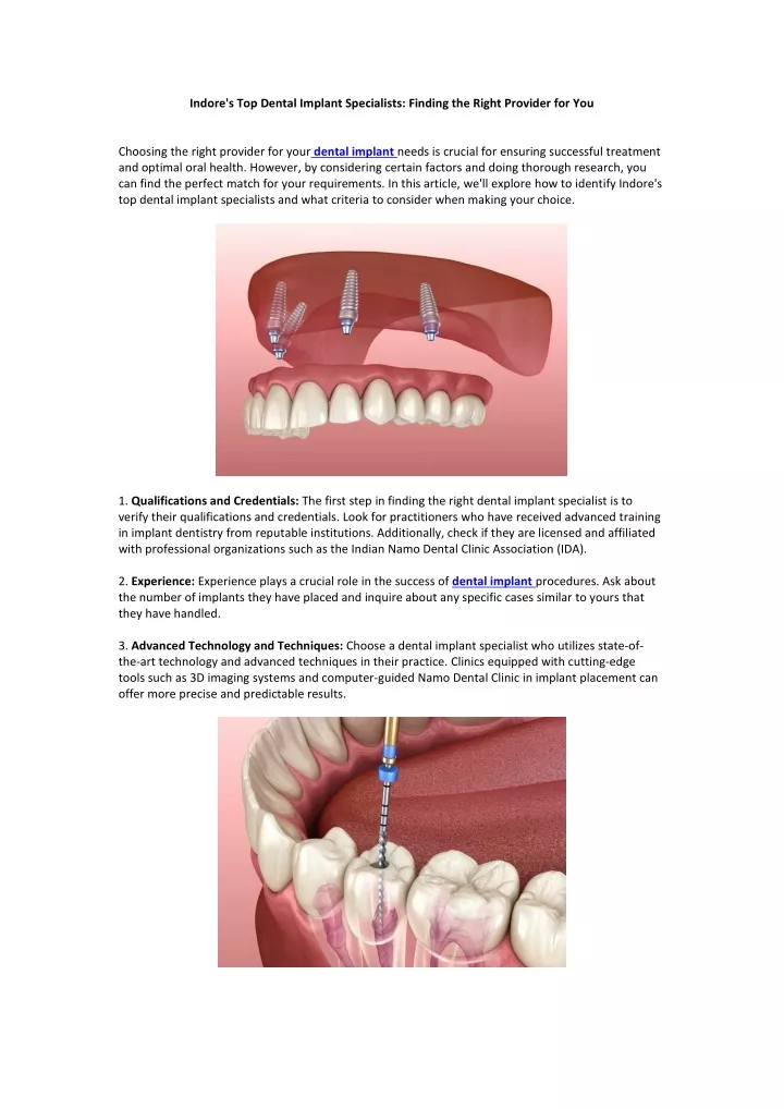 indore s top dental implant specialists finding