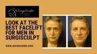 Look at the best Facelift for Men in SurgiSculpt