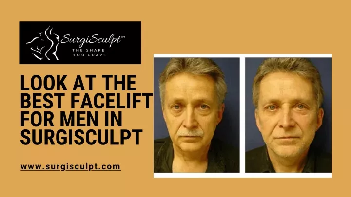 look at the best facelift for men in surgisculpt