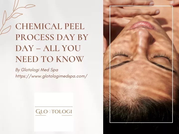 chemical peel process day by day all you need