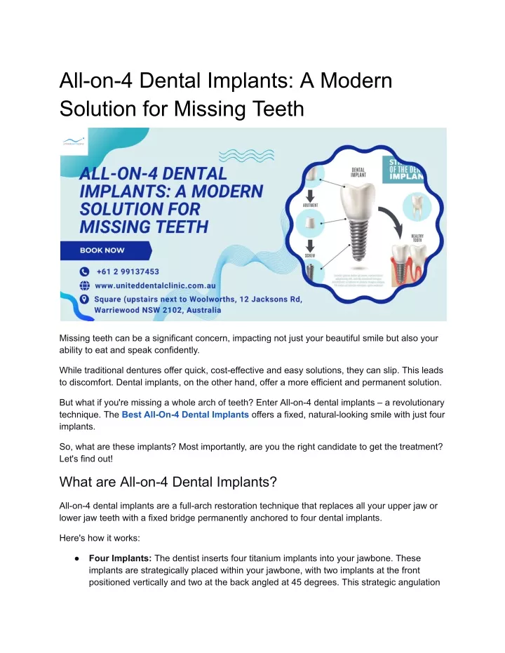 all on 4 dental implants a modern solution