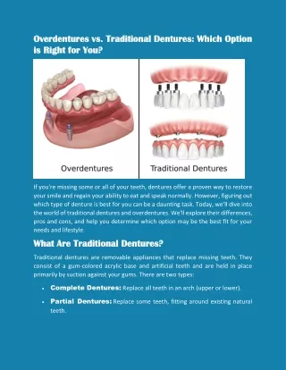 Overdentures vs. Traditional Dentures: Which Option  is Right for You?