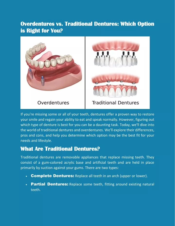 overdentures vs traditional dentures which option
