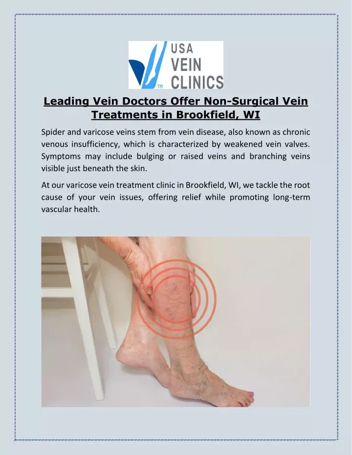 leading vein doctors offer non surgical vein