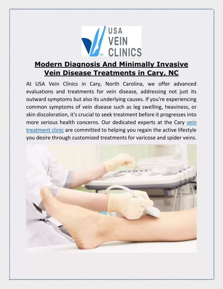 modern diagnosis and minimally invasive vein