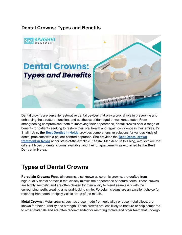 dental crowns types and benefits