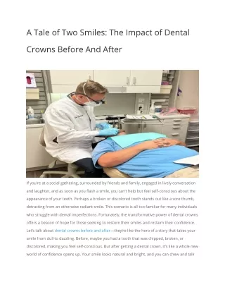 A Tale of Two Smiles The Impact of Dental Crowns Before And After